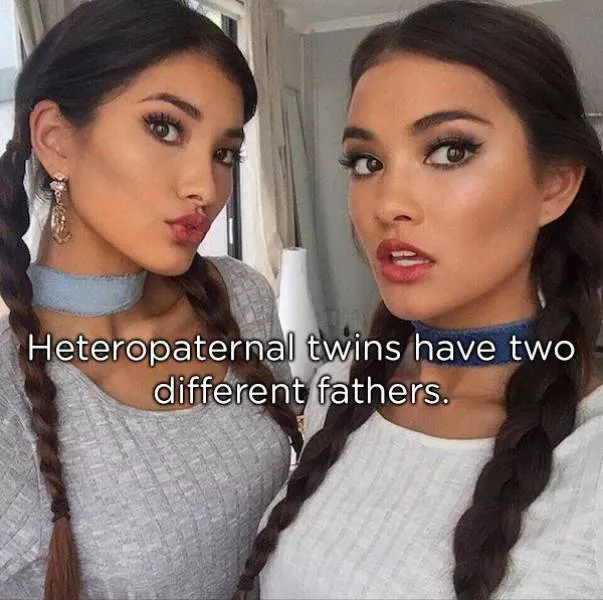 Amazing facts about twins