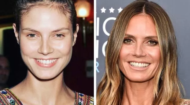 Models before and after they get famous - #14 