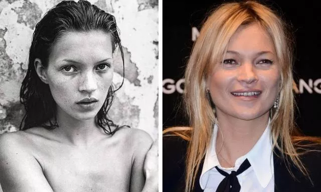 Models before and after they get famous