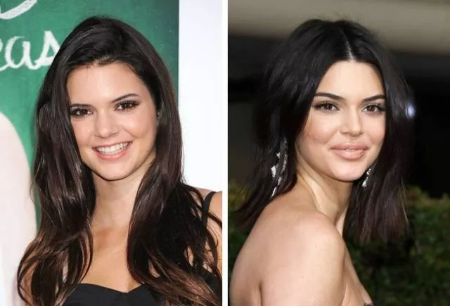 Models before and after they get famous - #8 