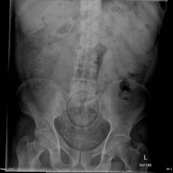 The 3 most terrible x rays in the world - #3 