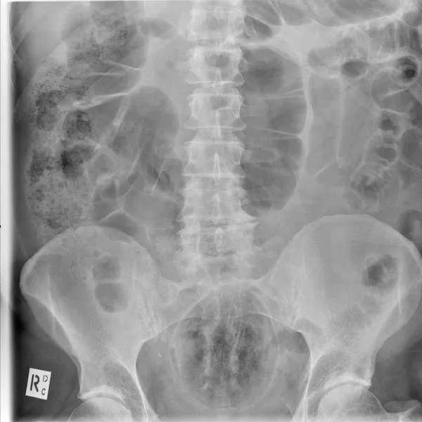 The 3 most terrible x rays in the world - #7 