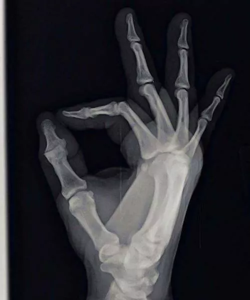 The 3 most terrible x rays in the world - #9 