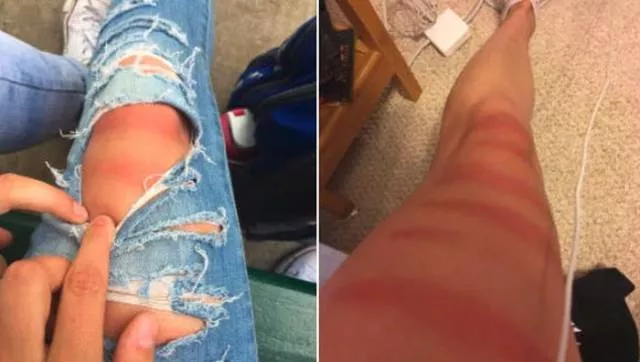 Ripped jeans fails