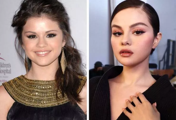 Evaluation of celebrities in recent years - #14 Selena Gomez (2008 vs 2020)